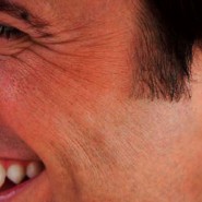 L’impianto dentale